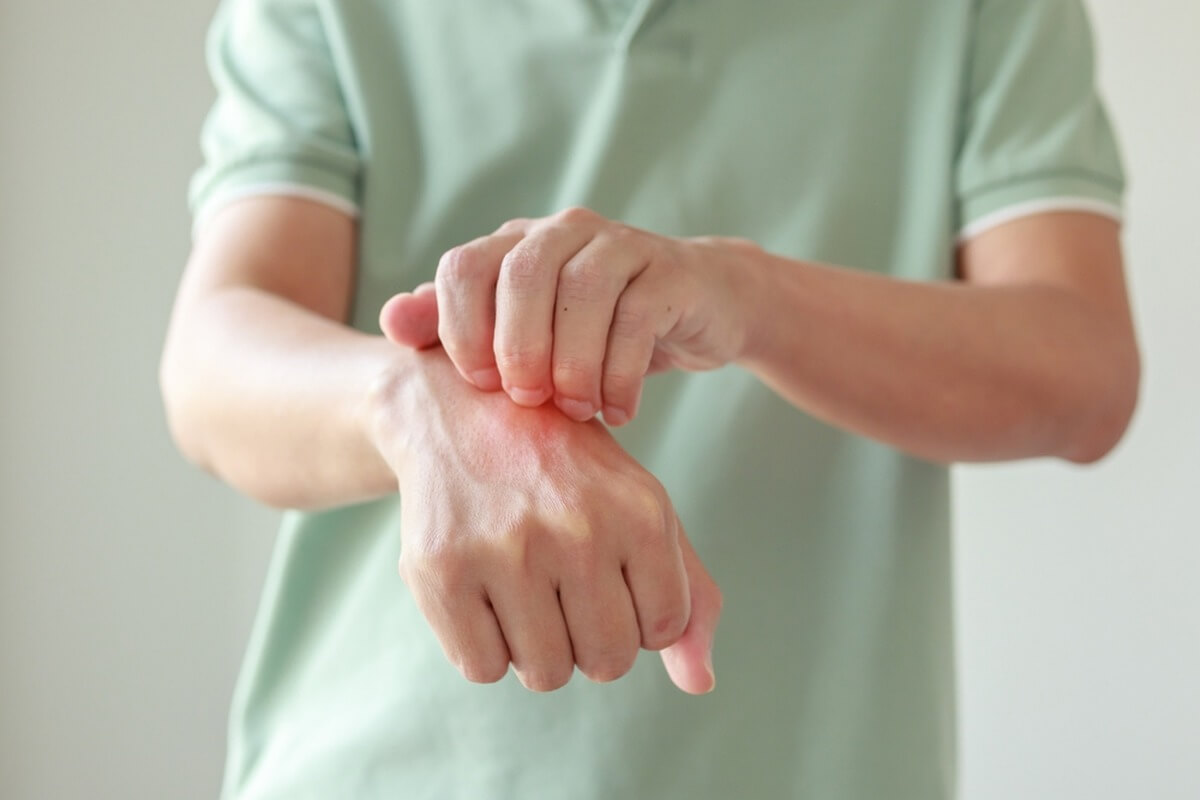 i.php?p=Adult cu dermatita atopica.jpg