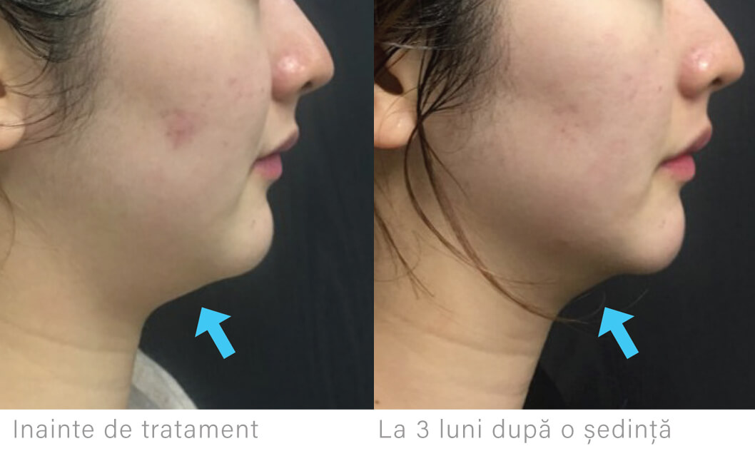 i.php?p=Liftera-gusa (1).jpg