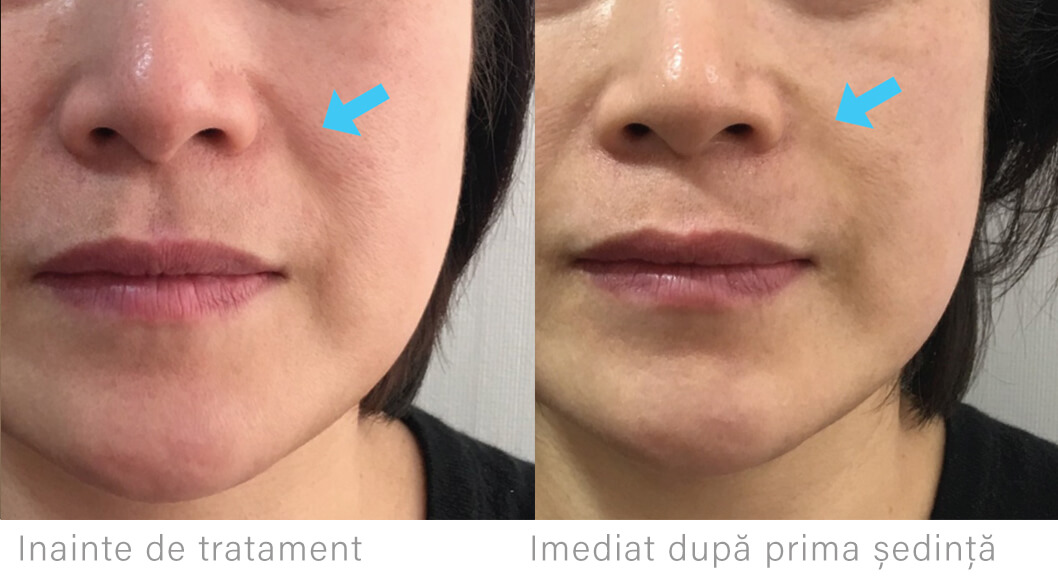 i.php?p=Liftera-riduri (1).jpg